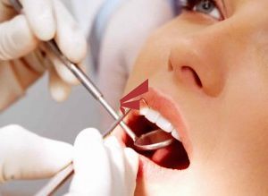 Imóvel serviços para Compra